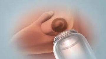 Hướng dẫn mẹ cách kích vắt sữa bằng tay đúng cách