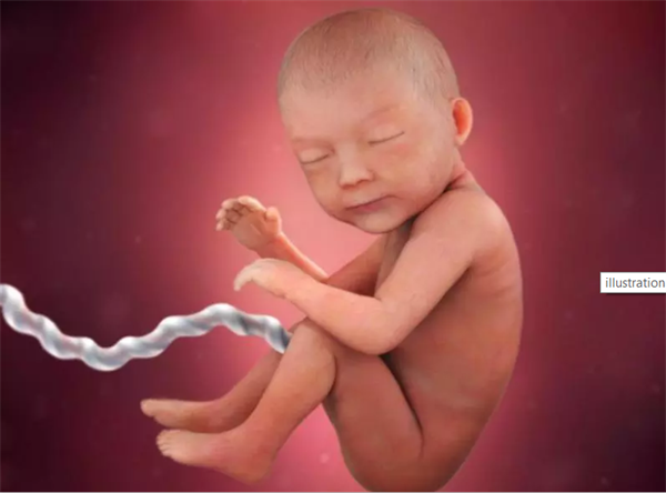 Thai nhi 30 tuần tuổi